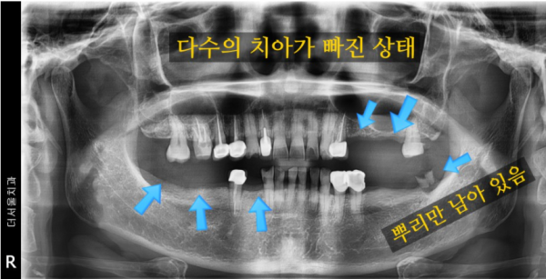 d579ab56dd8cded2de82ec0f6d764b0c_1622774959_8491.png