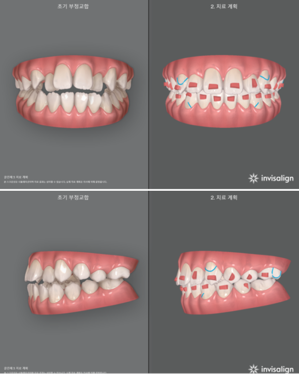e74de5845106e9b433957911d59599b9_1625672055_5006.png