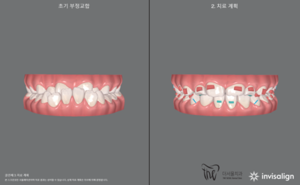 1ed38a853e63517651a5106b15a568a9_1638105337_0578.png