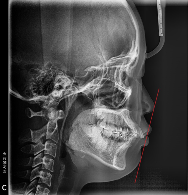 06963b7e2efa35088cc080fc3b630c7f_1646492732_5735.png