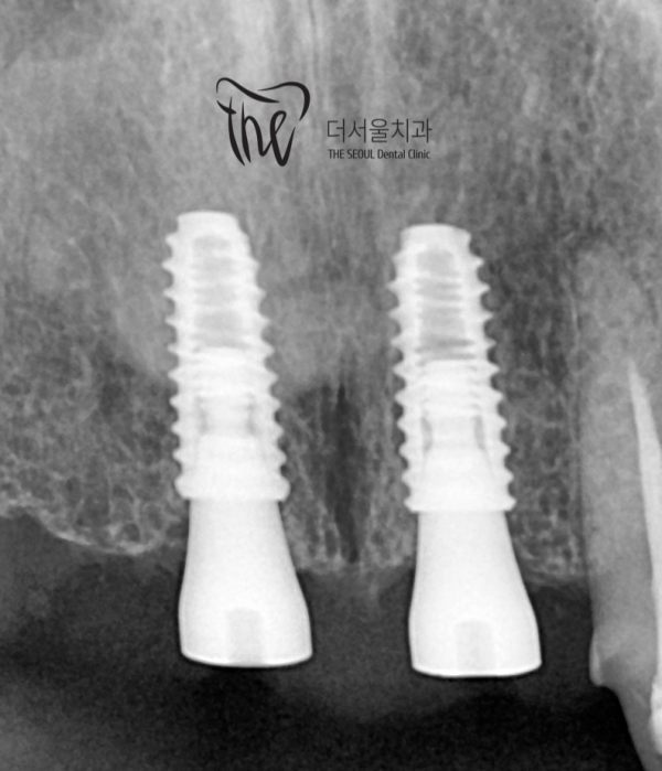 dddb8a96d25b4e364fbcc6dd522852c3_1658592008_8081.png