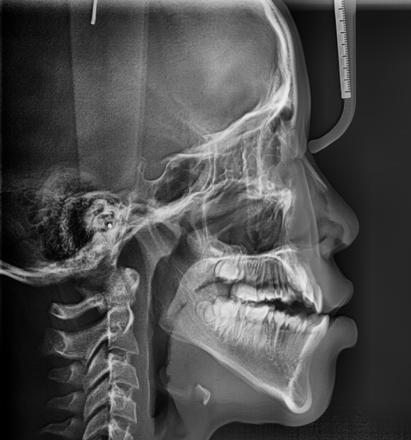 8e3b2a080321ab05f6b525bf267e5fe5_1663429412_5217.png