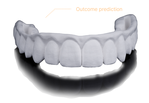 Outcome prediction