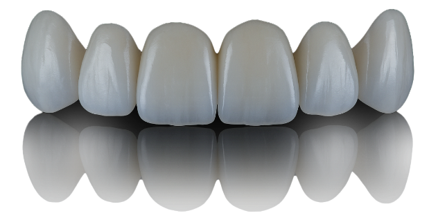 전문 기공사가 만들어내는 정교한 오랄 디자인