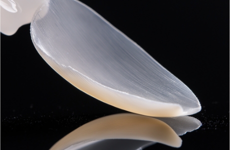 치료 후 구강 내에서 변색과 착색이 가장 적은 보철