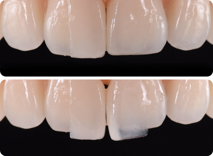오랄디자인 서울 기공소