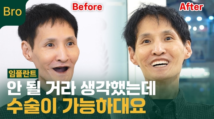 실제 환자가 이야기하는 임플란트 후기 안될거라 생각했는데 수술이 가능하대요