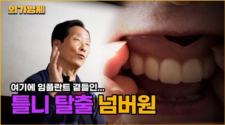 내 치아처럼 자연스러운 임플란트 선택 가이드 틀니 탈출 넘버원